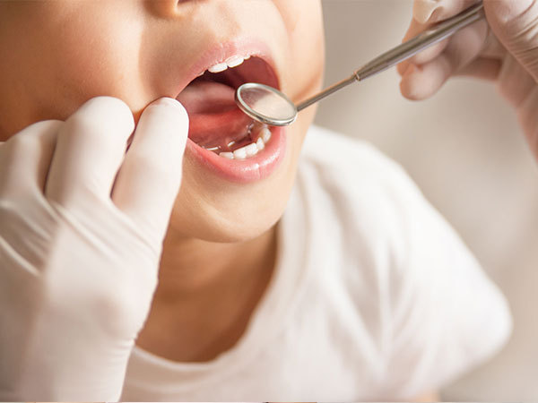 こどもの歯の治療方法